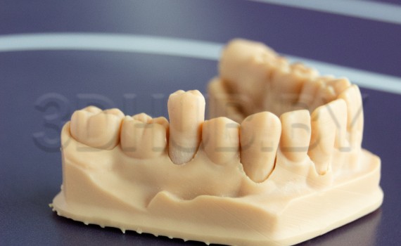 Разборная модель Геллера из Dental Model Resin