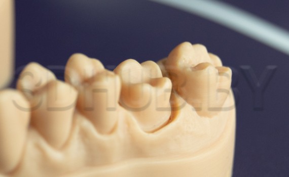 Разборная модель Геллера из Dental Model Resin