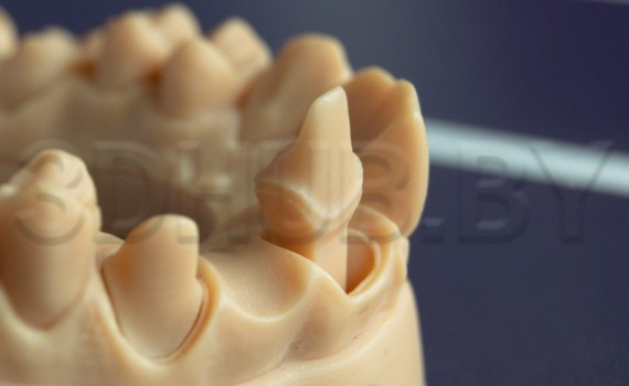 Разборная модель Геллера из Dental Model Resin