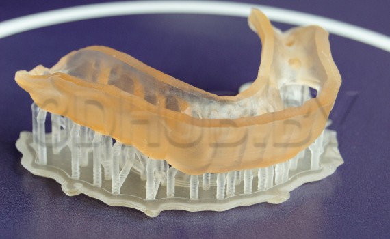 Хирургический шаблон из стерилизуемого Dental SG Resin