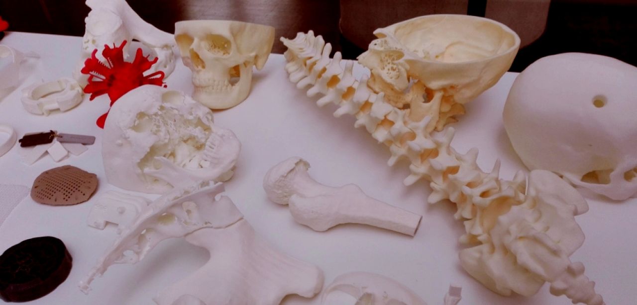3d printed models, medicine peek